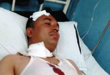 टाईम बम पड्किदा पत्रकार पाण्डे सहित प्रहरी जवान घाइते, घटनाप्रति सर्वत्र निन्दा